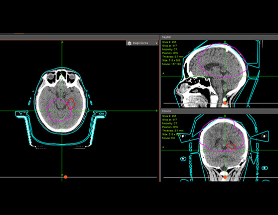 Image: contouring on computer