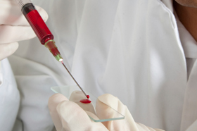 Biomarker Blood Test Accurately Confirms Remission In Patients
