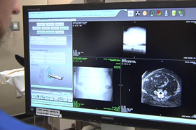 American Society For Radiation Oncology Astro American Society